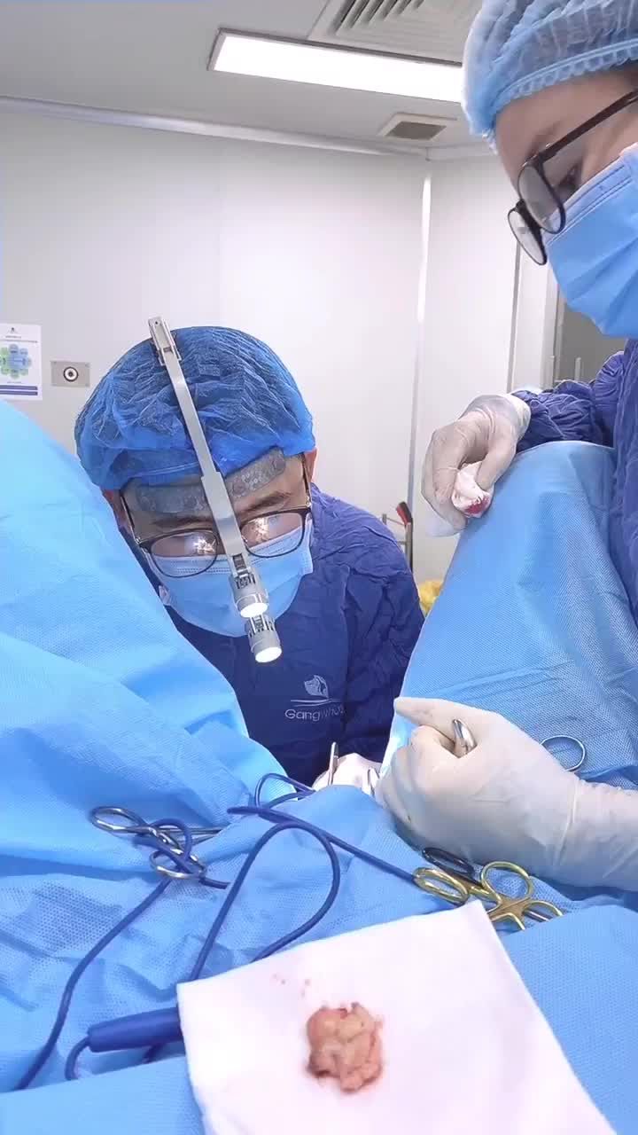 THU CƠ TRẺ HÓA “CÔ BÉ” CHUẨN KÍCH THƯỚC NÀNG MONG MUỐN